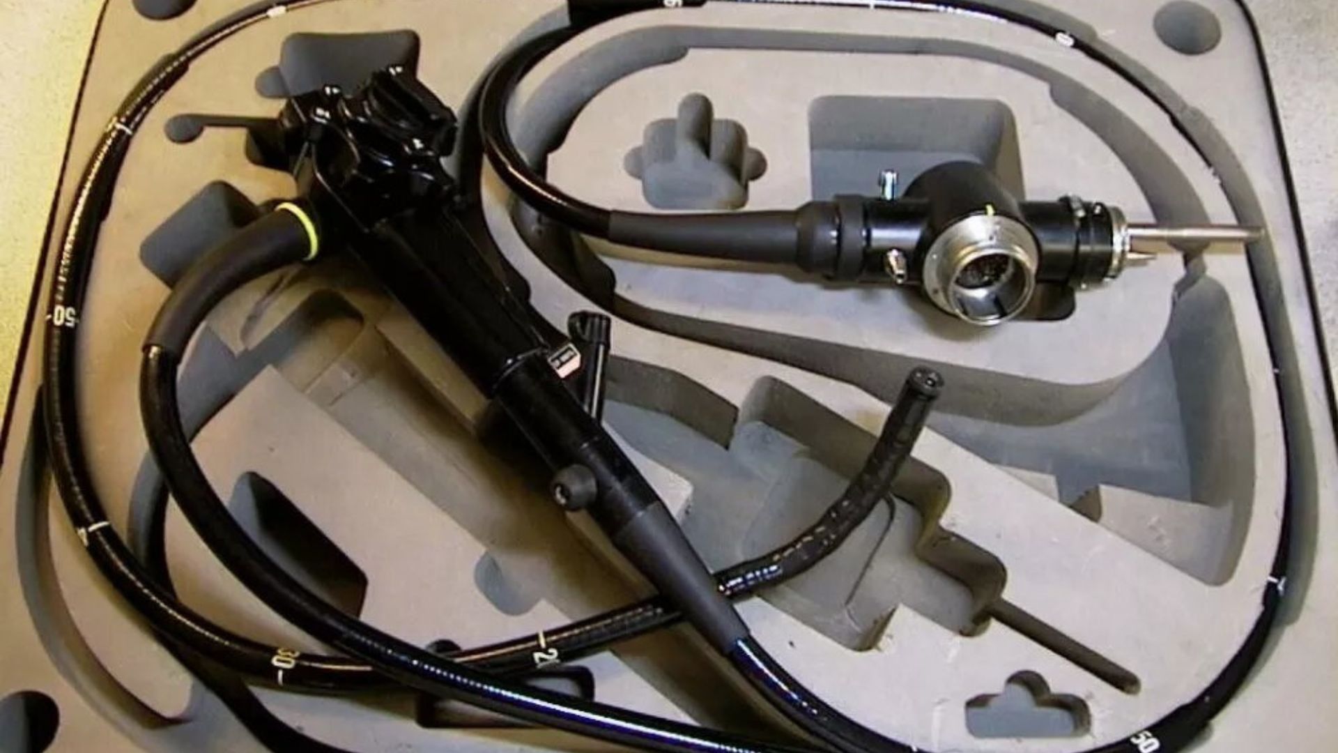 Чем вооружены медики для борьбы с эпидемией онкозаболеваний кишечника