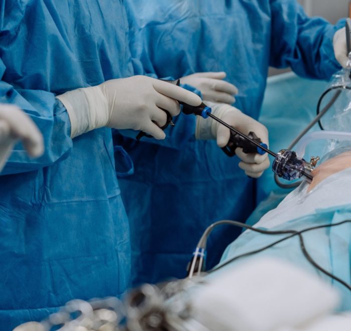 Низкая резекция прямой кишки с формированием тазового резервуара