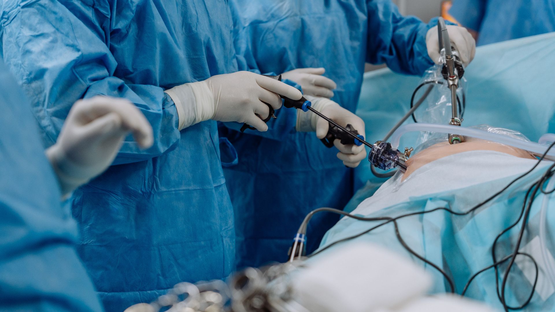 Низкая резекция прямой кишки с формированием тазового резервуара