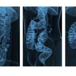 Диагностика рака толстой кишки без колоноскопии