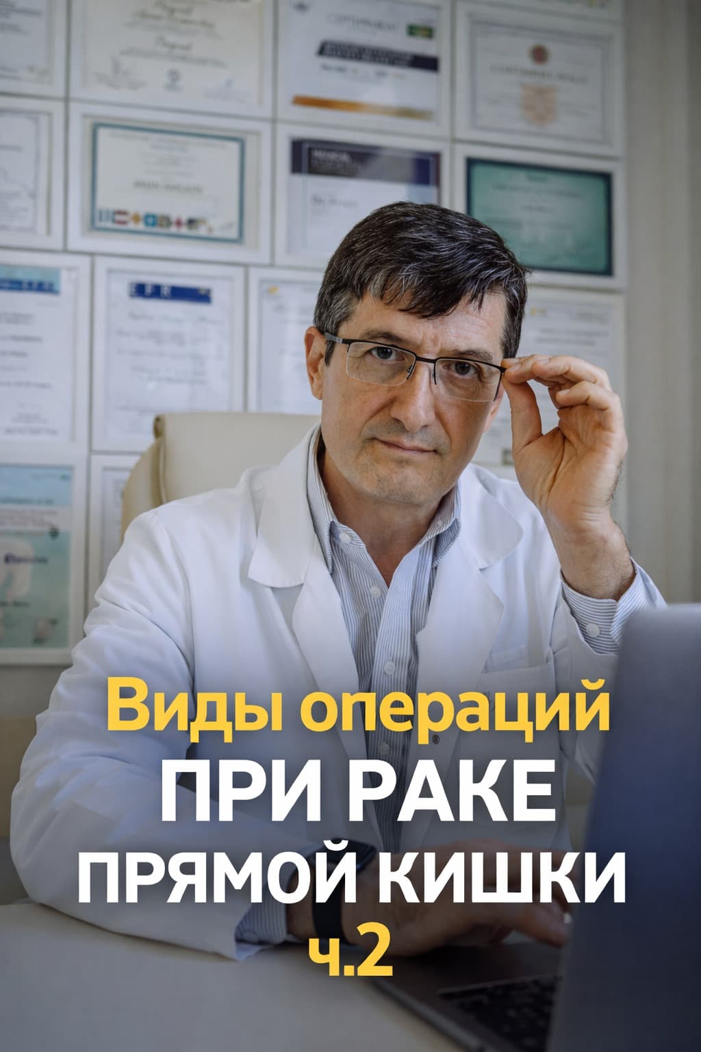 Виды операций при раке прямой кишки ч.2