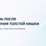 Жизнь после удаления толстой кишки - стул, питание, стома и восстановление